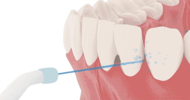 水牙线明星推荐,网红明星都在用的牙膏