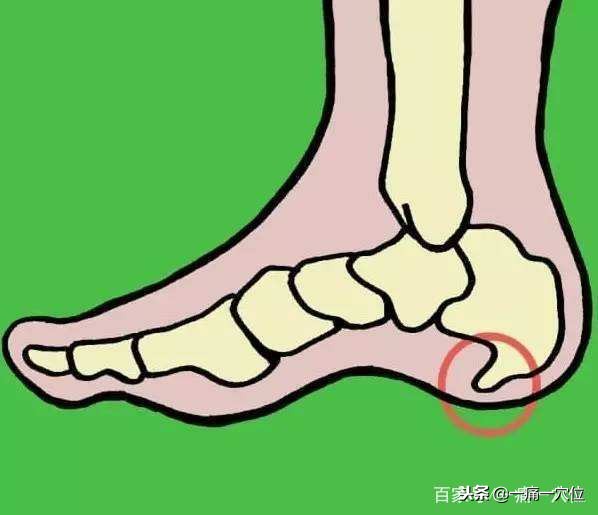 老年足跟痛的治疗方法,老年人足跟痛一招教你解决