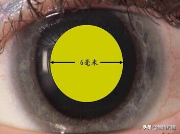 眼压异常的症状,眼压偶尔偏高一点有问题没