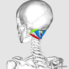 颈椎富贵包怎么消除最有效方法,怎样快速消除颈椎的富贵包