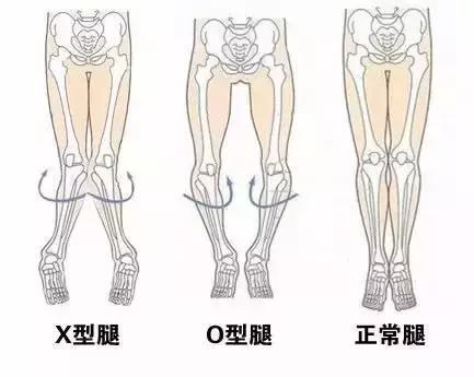 宝宝腿不矫正怎么办,宝宝腿不伸展怎么办