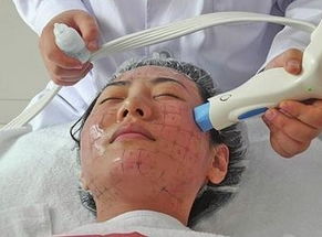 什么是热玛吉除皱术千万别入坑,什么是热玛吉整形项目