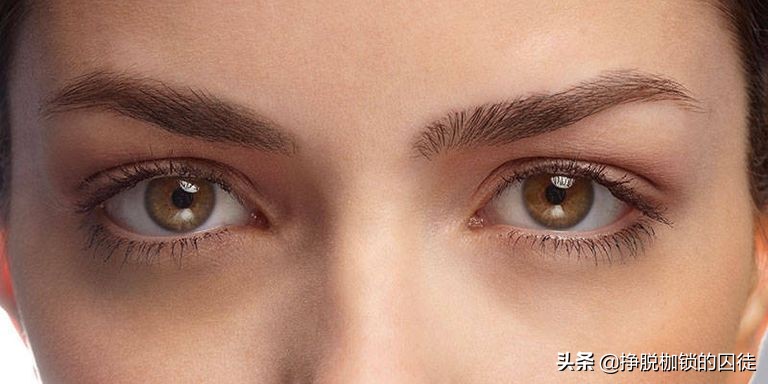 女孩黑眼圈重什么原因造成的,黑眼圈是什么原因造成的啊