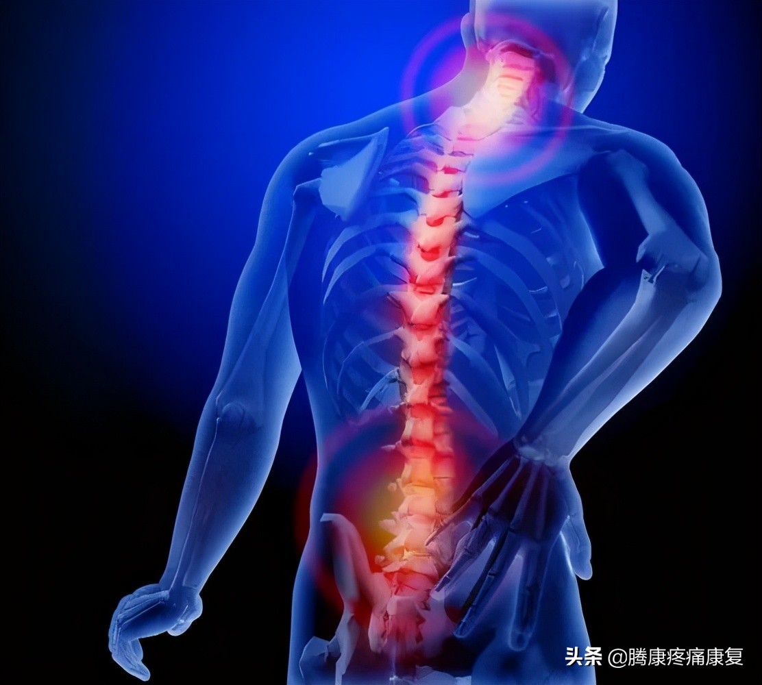 强直性脊柱炎有什么预防的方法吗,强直性脊柱炎预防与锻炼方法