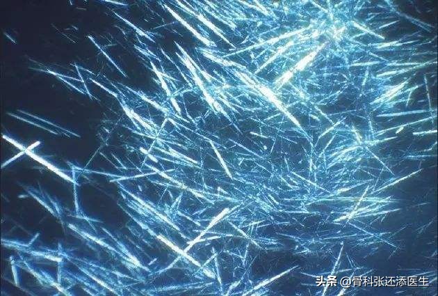 痛风能治愈？尿酸监测，药品选择，除了戒口，我们聊点深入的科普