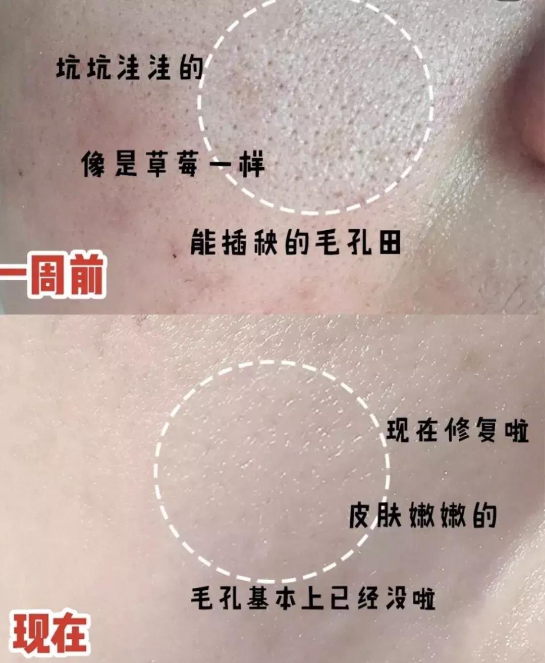 适合皮肤暗黄的护肤品李佳琦推荐,淡斑提亮肤色李佳琦推荐