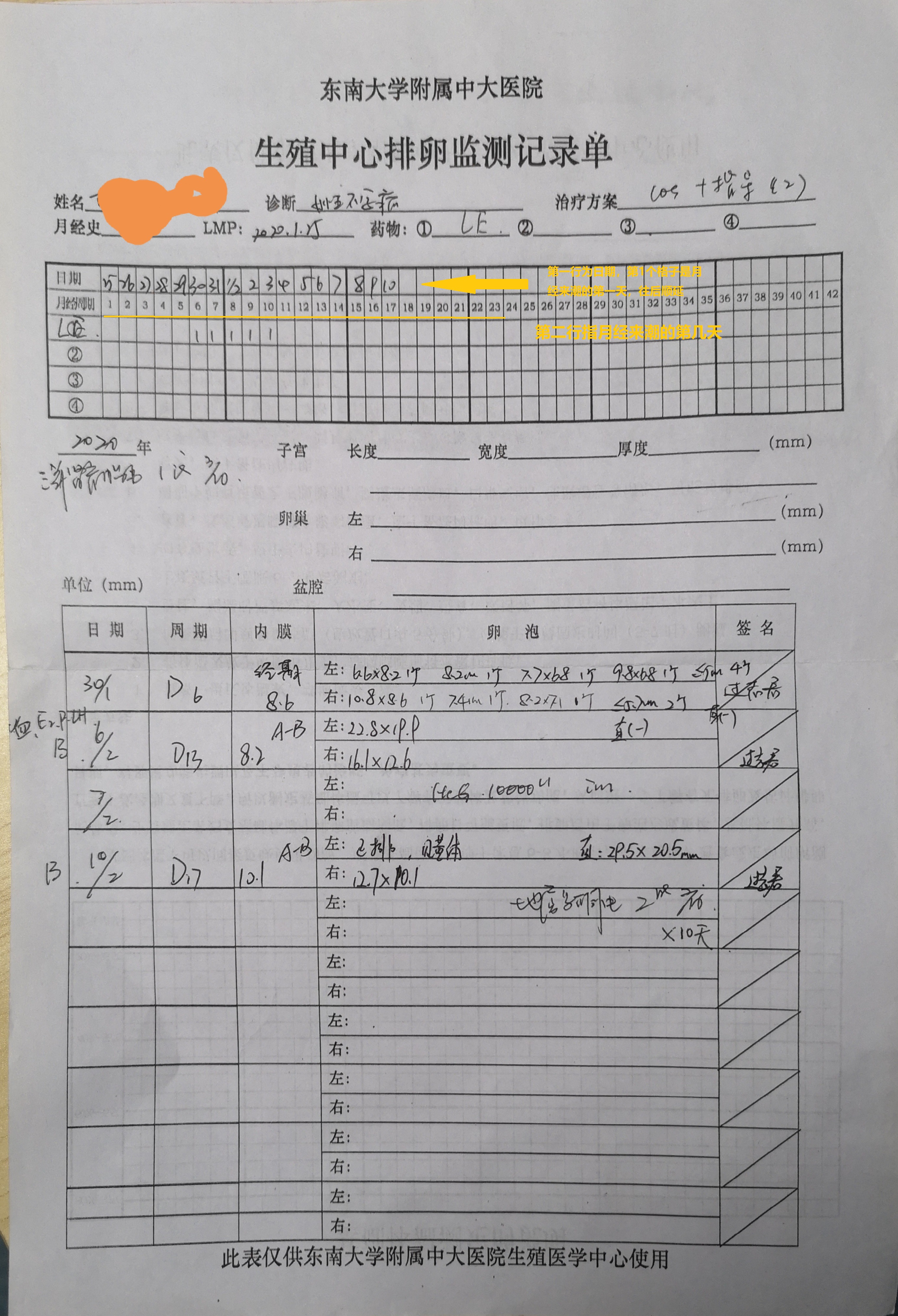 关于排卵障碍型不孕的知识,排卵障碍不孕