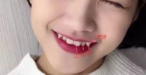 “*牙虎**这么多余,可以拔了吗?”看看明星你就知道答案了