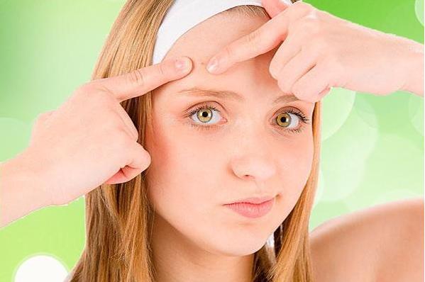 如何区分各种痘印的原因,痘印有哪些种类型