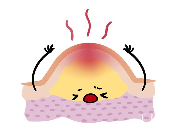 胡吃海塞后怎么补救,胡吃海喝长痘之后应该怎么吃