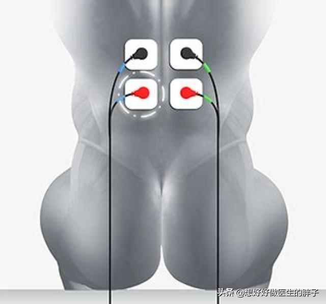 有些患者膝盖疼痛是由腰椎间盘突出压迫神经导致的,千万别忽视