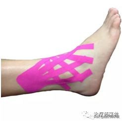 踝关节不稳康复训练,慢性踝关节不稳的运动康复修复