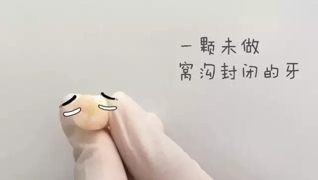 什么是儿童窝沟封闭？会不会痛？1分钟视频带你看懂#雅悦齿科#