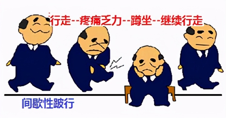 腰椎管狭窄保守治疗效果,腰椎管狭窄手术和保守治疗哪个好