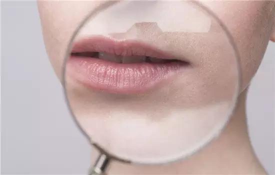 怎样淡化唇纹最有效,唇纹深怎么淡化最有效的方法