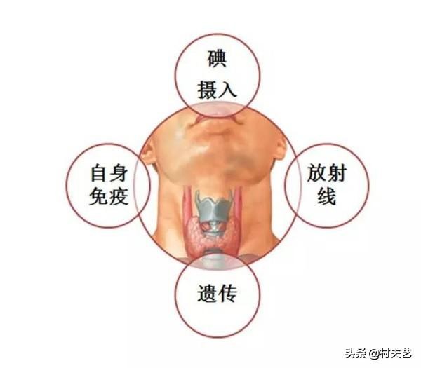体检常见的六种病,体检常见的10种症状
