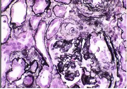肾毒性食物一览表,肾毒性的药物排名