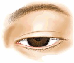 科普篇眼部整形的七大误区,关于眼整形这些事你一定要知道