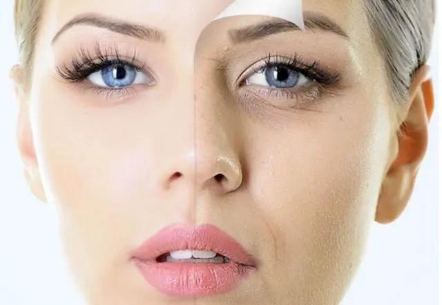 动态纹会变成静态纹,静态纹和动态纹哪个容易去掉