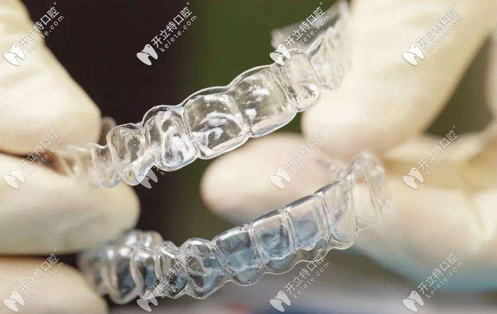 南京整牙哪家医院好多少钱,南京成人隐形整牙多少钱