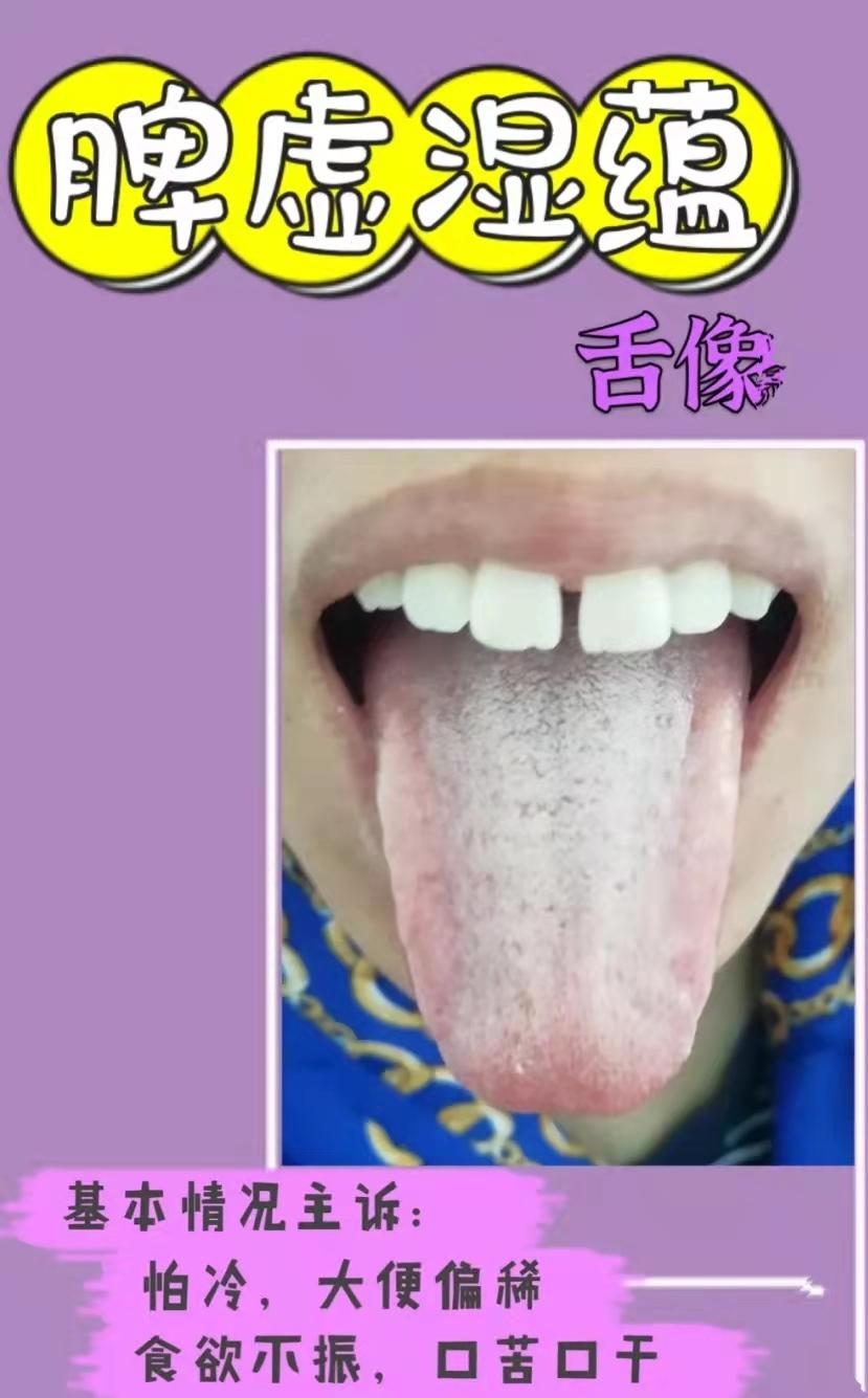 脾胃虚健脾胃的中药,十种健脾胃的中成药该如何调理