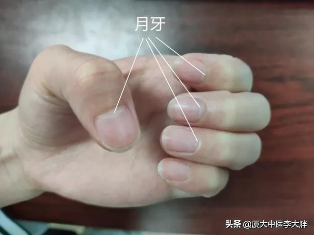 激情过后总是尿频、腰酸，这到底是不是肾虚，该怎么调理？