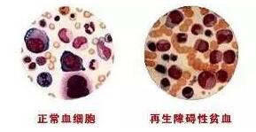 孕期出现这些症状，可能是身体在告诉你，你贫血了