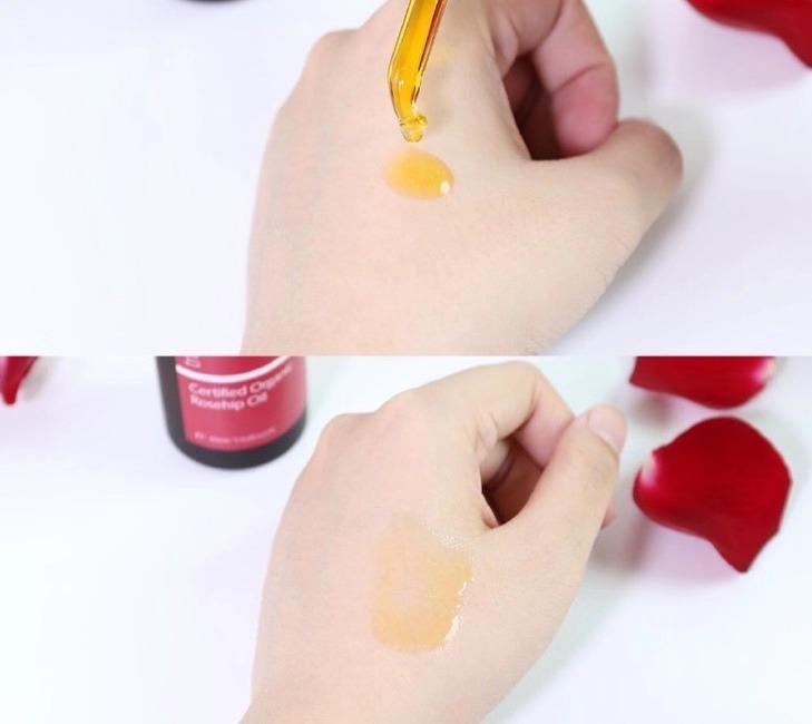 祛痘印！抗皱！淡化妊娠纹！温和滋润抗敏的玫瑰果油