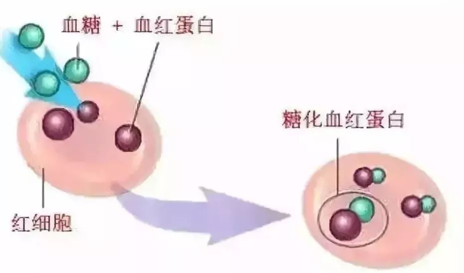 糖化血红蛋白高血糖正常啥原因,糖化血红蛋白高葡萄糖高怎么回事