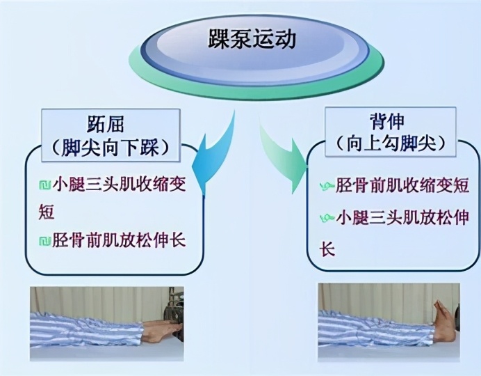 孕妇为何容易静脉血栓,孕产妇静脉血栓的预防宣教