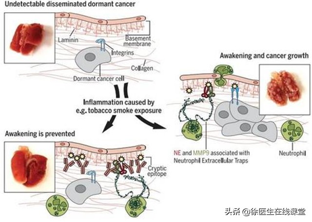 四种血型哪种血型最长寿,a型o型b型ab型哪种血型寿命最长
