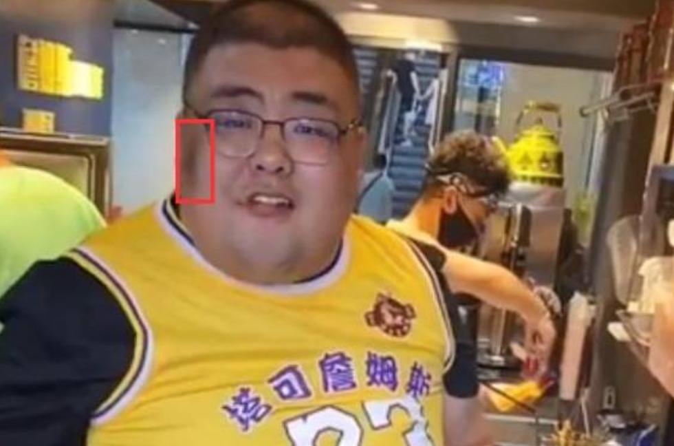 吃播泡泡龙意外去世，29岁体重320斤，生前脸上黑斑是早有预兆？