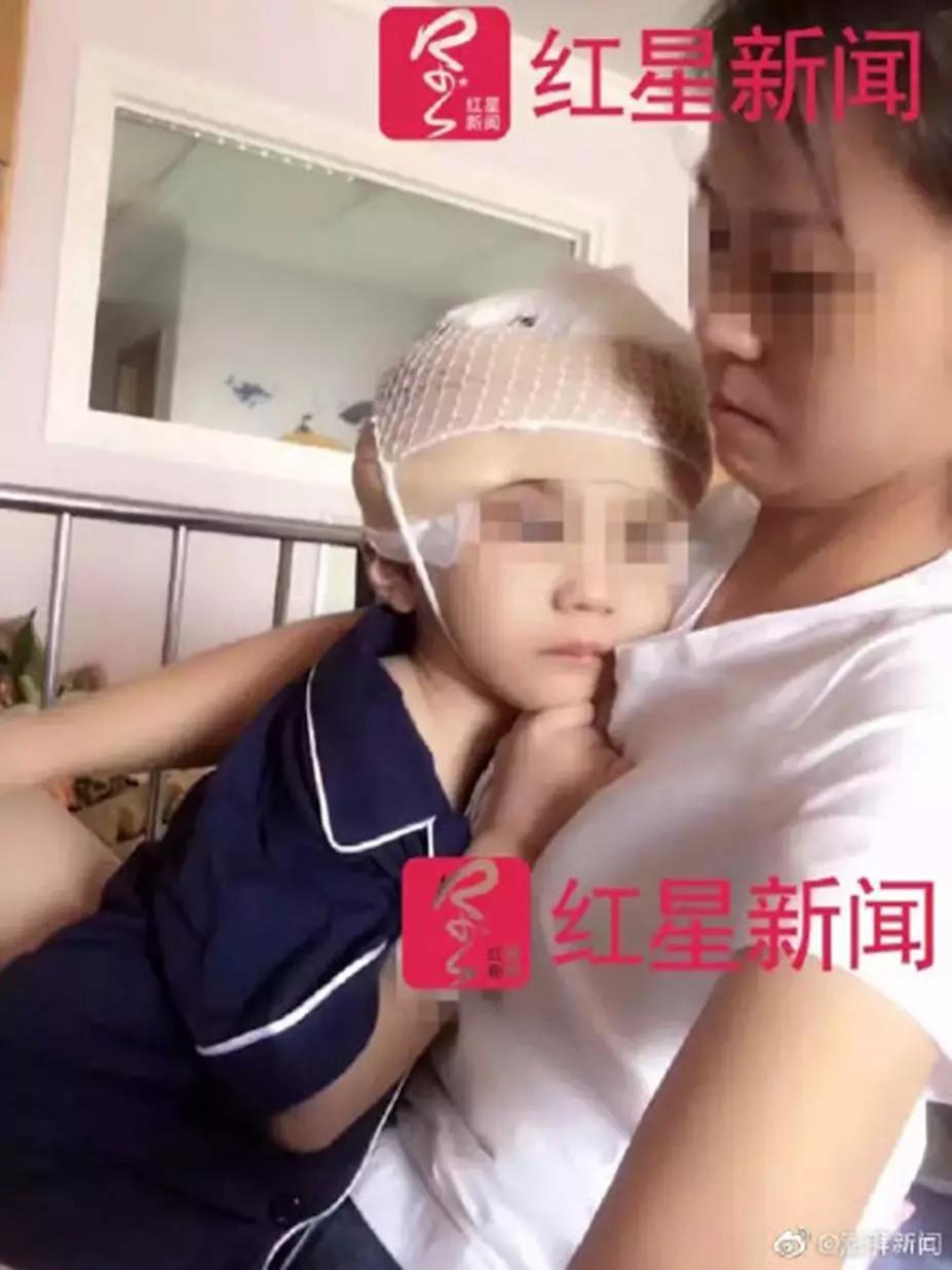 男童被继母虐待成植物人，生父被以虐待罪及遗弃罪起诉