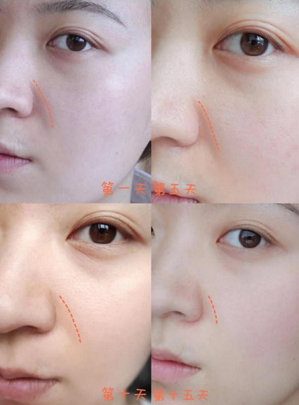 陈乔恩为什么越来越漂亮,陈乔恩肌肤娇嫩