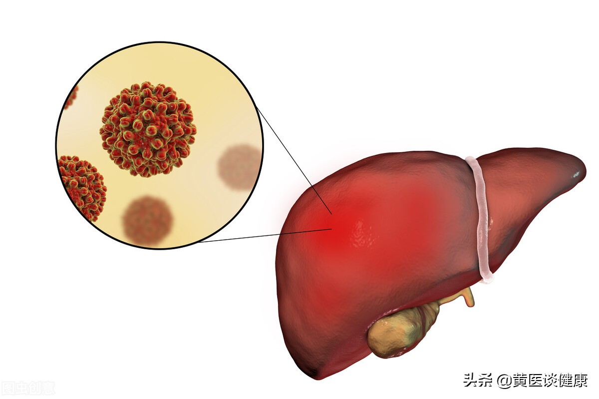 抗病毒治疗谷丙转氨酶升高,乙肝抗病毒期间谷丙转氨酶升高