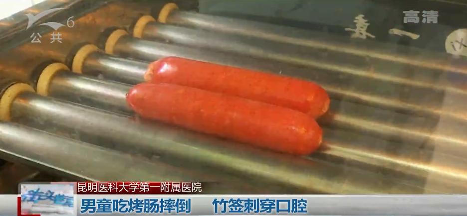 吃烤肠被竹签刺穿咽喉，医生：如果再刺深一点，孩子可能就当场死亡了