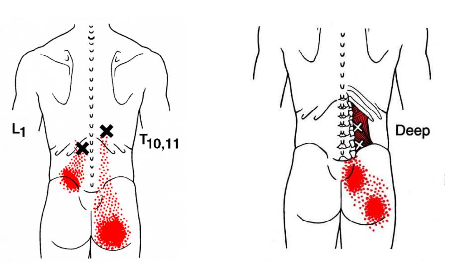 腰疼不是骨头疼怎么回事,腰疼不是左边疼就是右边疼