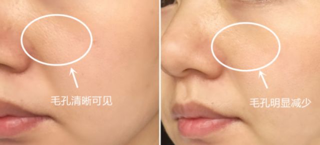 小黄瓜面霜保湿效果好吗,抗老修护保湿面霜澳洲