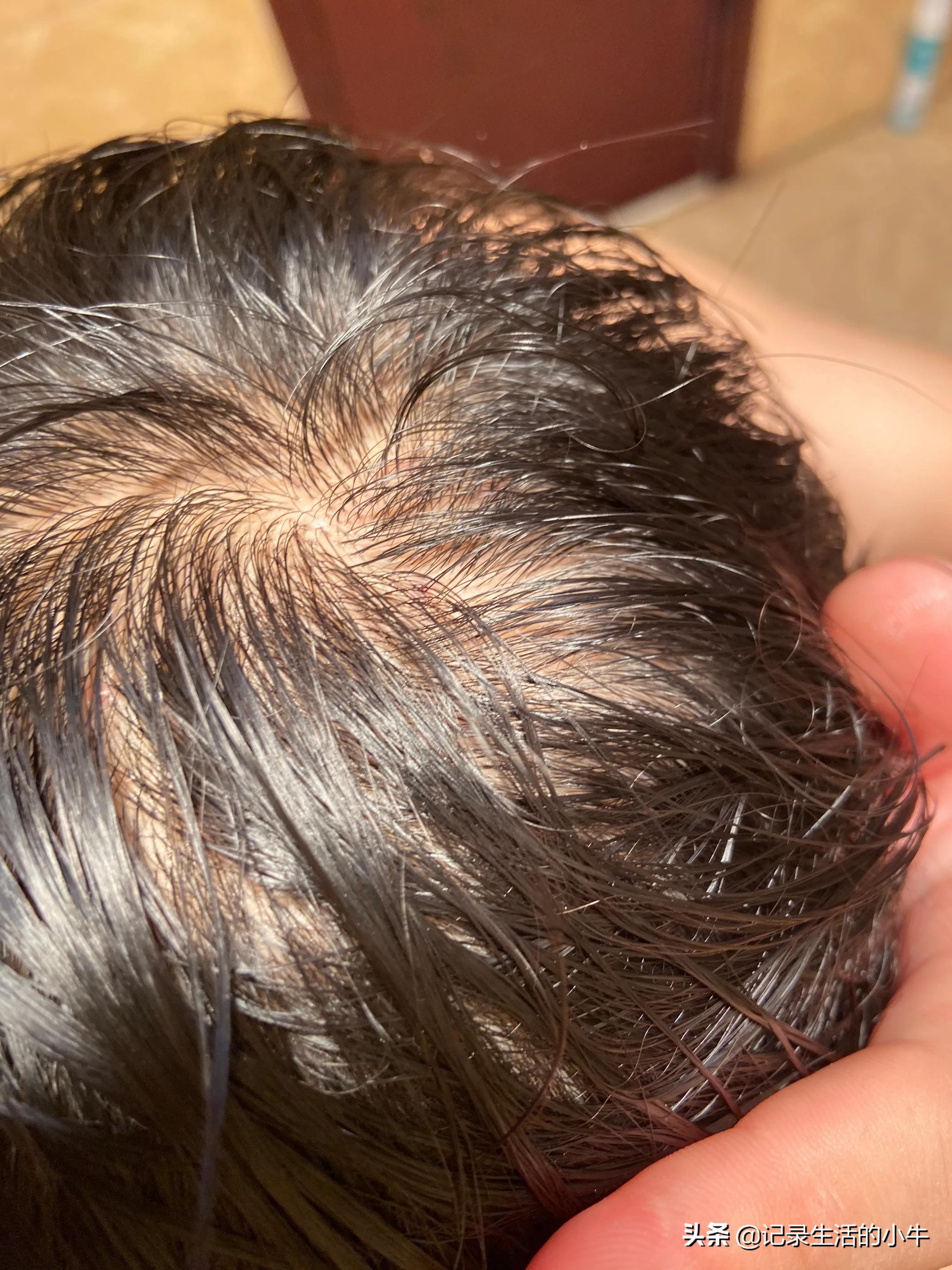 小米生发仪是真的吗,小米有品生发梳