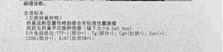 癌症理赔并不难界定病种是关键