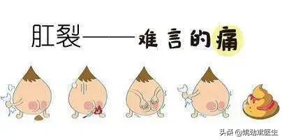 为什么女性肛裂发病率更高？