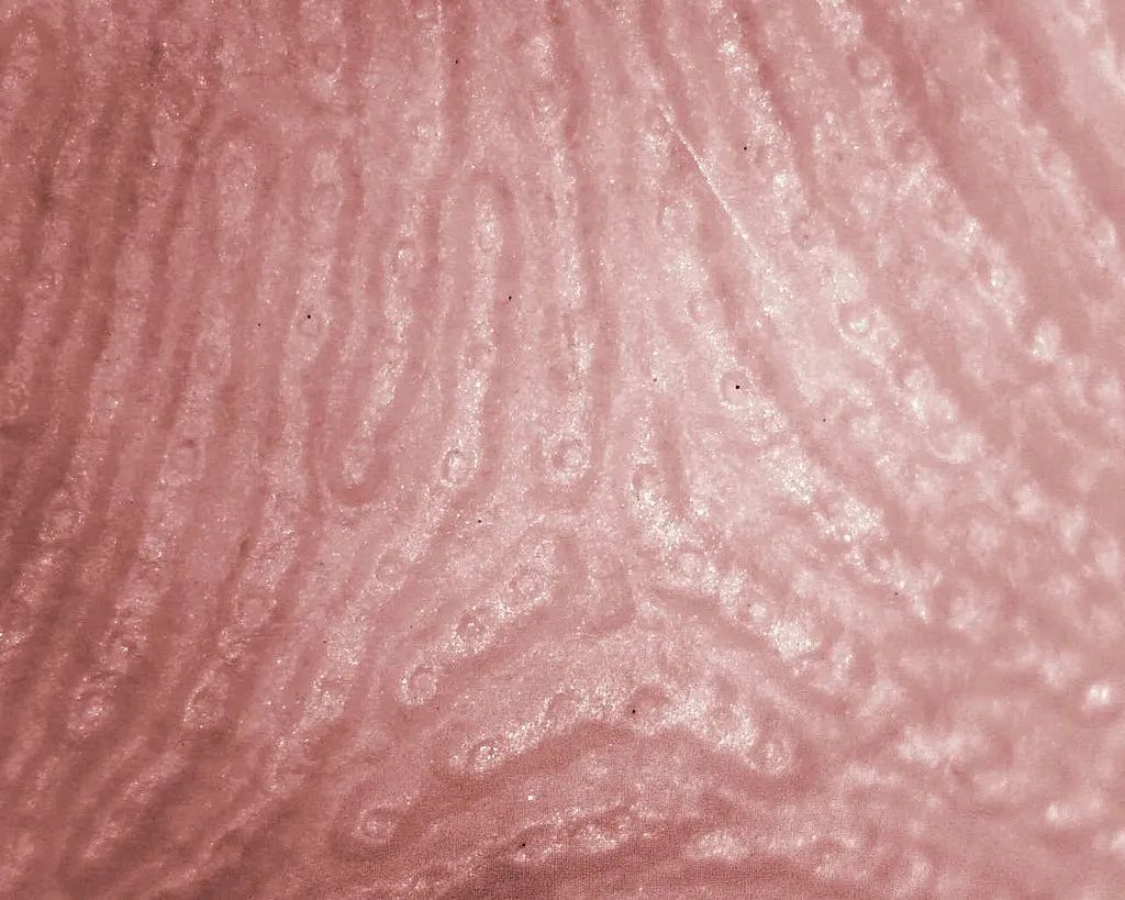 没有指纹的人的命运,天生无指纹的人多吗