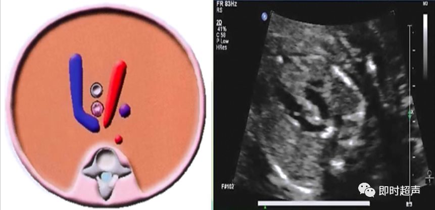 胎儿心脏三种血管关系模式图,25周的胎儿心脏弓切面多少正常