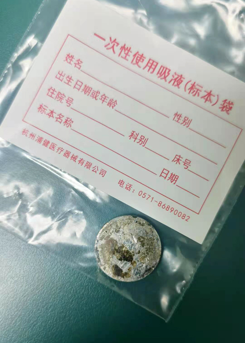 1岁男童误吞电池,一岁男童误吞电池