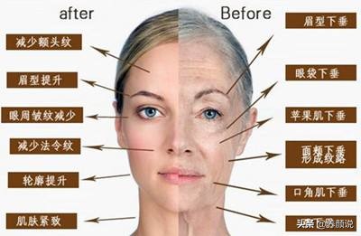 皮肤松弛、出现抬头纹，护肤品只可以控制，但这几项可以彻底解决