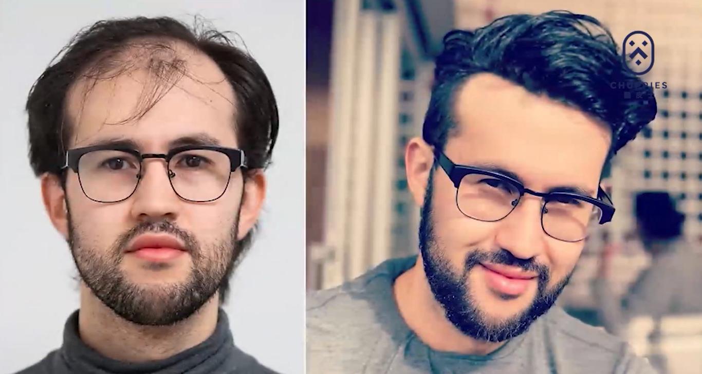 头顶窄的人适合什么发型假发,假发发型设计与脸型搭配