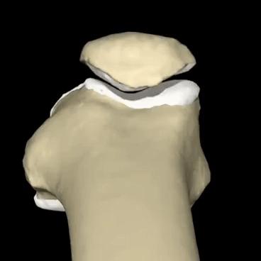 膝关节为什么疼,膝关节疼痛怎么治疗最好最有效