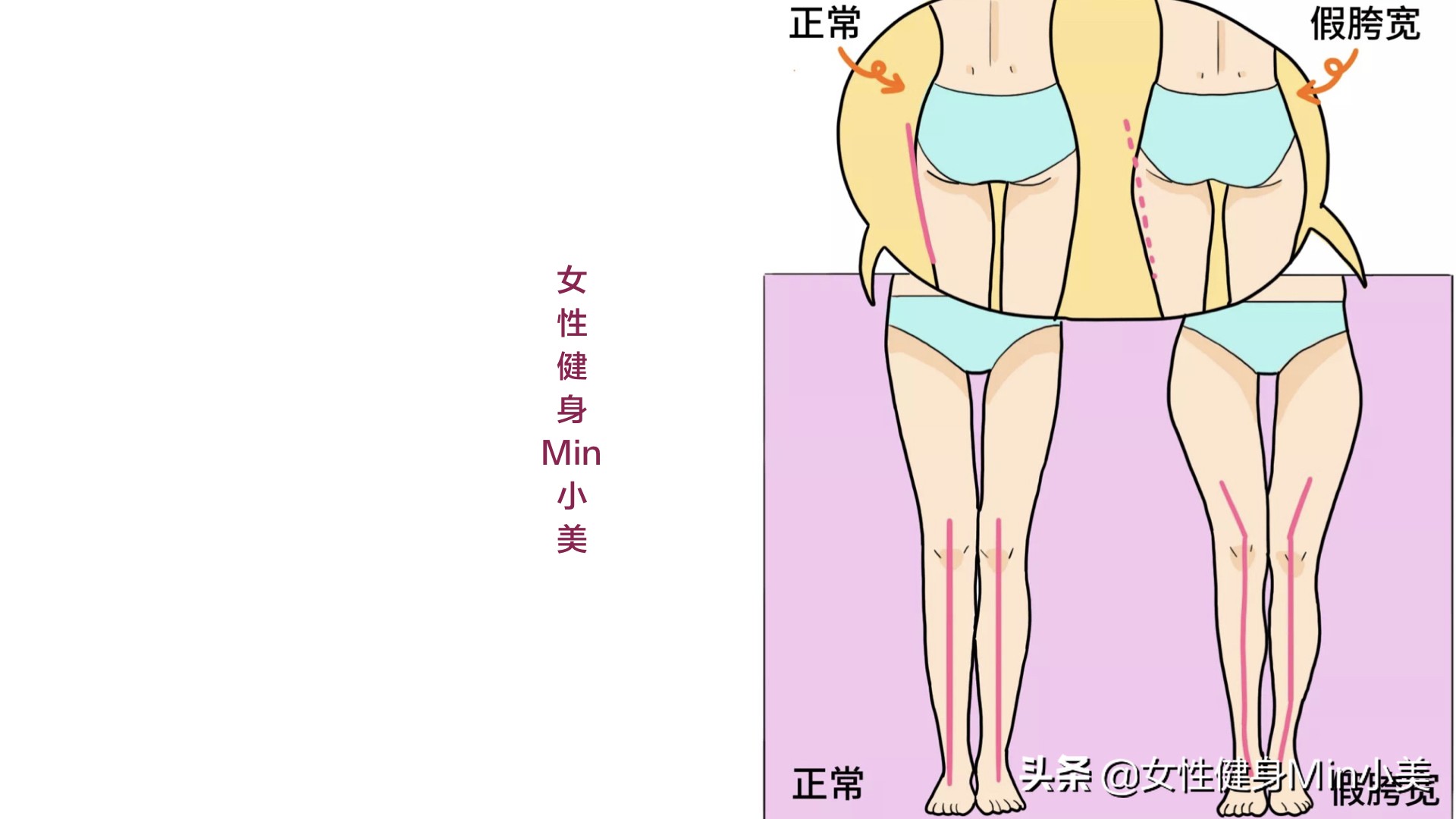 假胯宽大腿粗怎么办呢,假胯宽和大腿粗怎么办