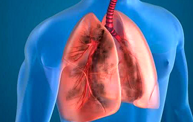 肺癌皮肤会出现哪些症状,肺癌发生时皮肤有什么异常表现