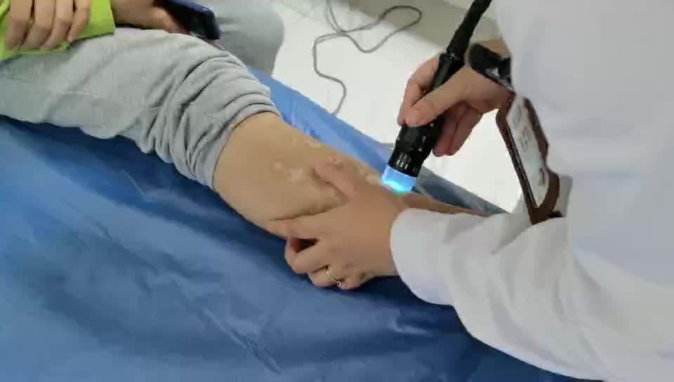 白癜风用308和311哪种激光效果好,白癜风311和308治疗仪有什么区别